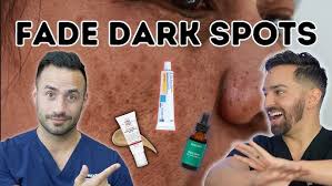 How to Get Rid of Dark Spots: A Complete Guide